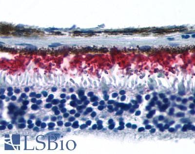 PathPlus™ Polyclonal Rabbit anti-Human Rhodopsin / RHO Antibody (Extracellular Domain, IHC)