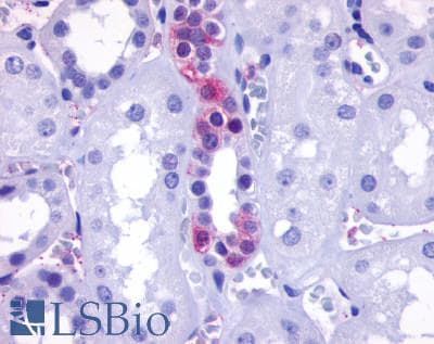 PathPlus™ ADGRF1 / GPR110 Antibody (N-Terminus)
