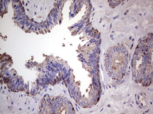 Monoclonal Mouse anti-Human PKM2 Antibody (clone 1F12, IHC, WB)