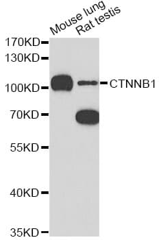 Polyclonal Rabbit anti-Human CTNNB1 / Beta Catenin Antibody (IHC, WB)