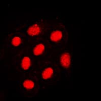 Polyclonal Rabbit anti-Human HNF4A / HNF4 Antibody (phospho-Ser313, IHC, IF, WB)