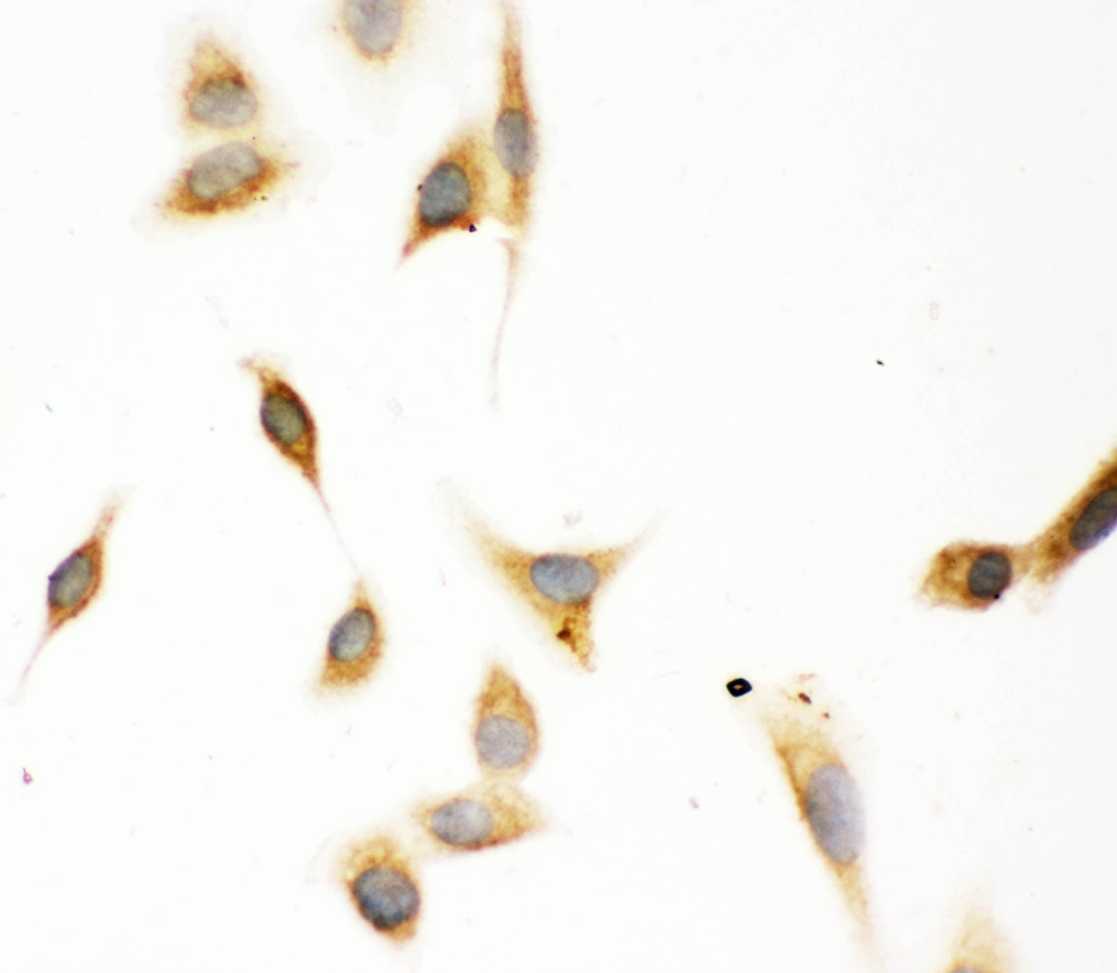 Junctin / ASPH Antibody (aa726-758)