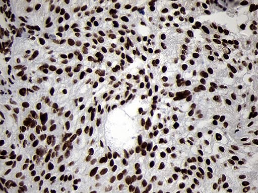 SMC1A / SMC1 Antibody (aa889-1016, clone OTI3G4, Carrier-free)