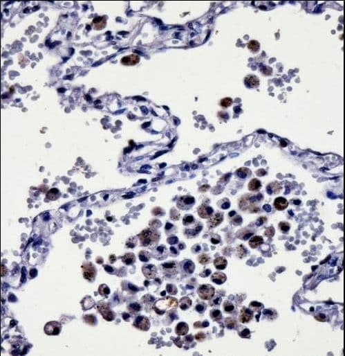 CYSLTR1 / CYSLT1 Antibody (aa144-172)