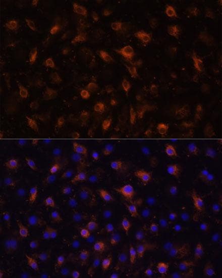 TLR4 Antibody