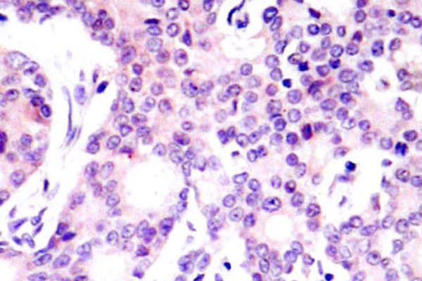NFKB1 / NF-Kappa-B Antibody (Val887)