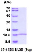 Human LINGO1 Protein (Recombinant His)