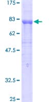 Human PECAM-1 / CD31 Protein (Recombinant GST)