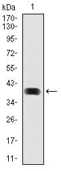 Monoclonal Mouse anti-Human MAP1LC3B / LC3B Antibody (clone 5H12, WB)