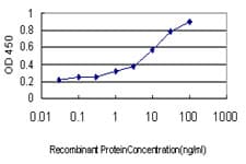 DHODH Antibody (clone 6E1)