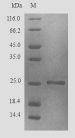 Blattella germanica Glutathione S-Transferase Protein (Recombinant 6His, N-terminus)
