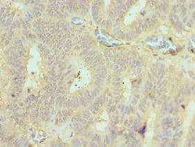 BMF Antibody (aa1-184)