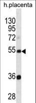 TEKT3 Antibody (aa110-138)