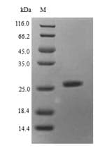 Mouse SAP130 Protein (Recombinant 6His, N-terminus)