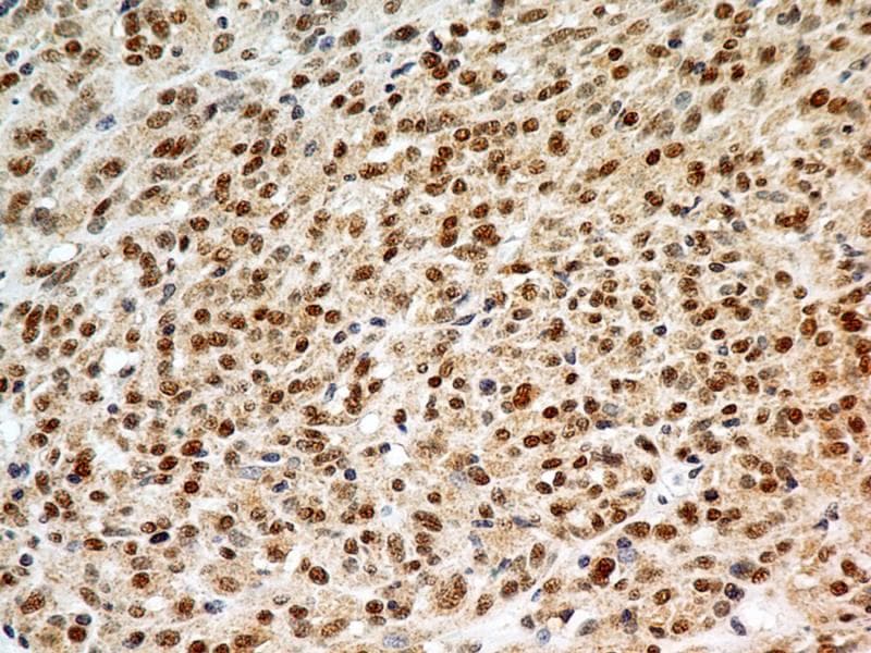FOXP1 Antibody (clone JC12)