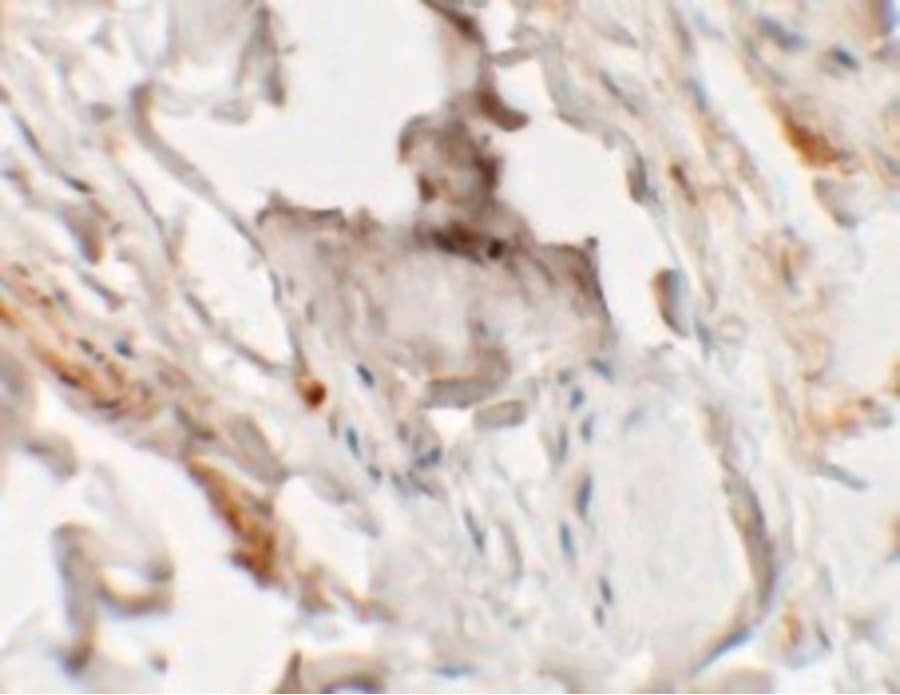 Polyclonal Rabbit anti-Human HHATL Antibody (IHC, IF, WB)