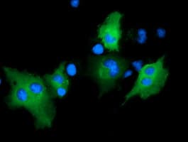 Monoclonal Mouse anti-Human ARHGAP25 Antibody (clone OTI11B9, IHC, IF, WB)