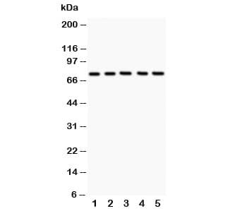 Polyclonal Rabbit anti-Human ALOX12 / 12 Lipoxygenase Antibody (aa609-628, WB)