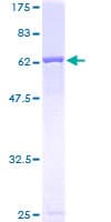 Human CALR3 Protein (Recombinant GST)