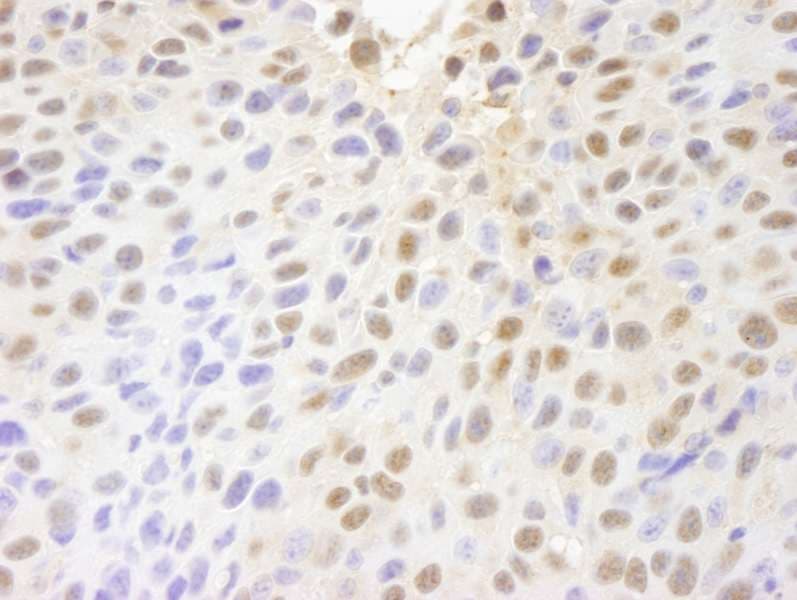 Polyclonal Rabbit anti-Human PARP10 Antibody (aa300-350, IHC)