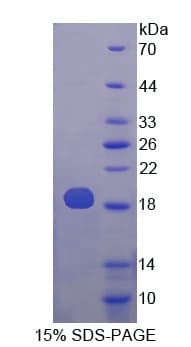 Human PLA2G10 Protein (Recombinant His-T7)