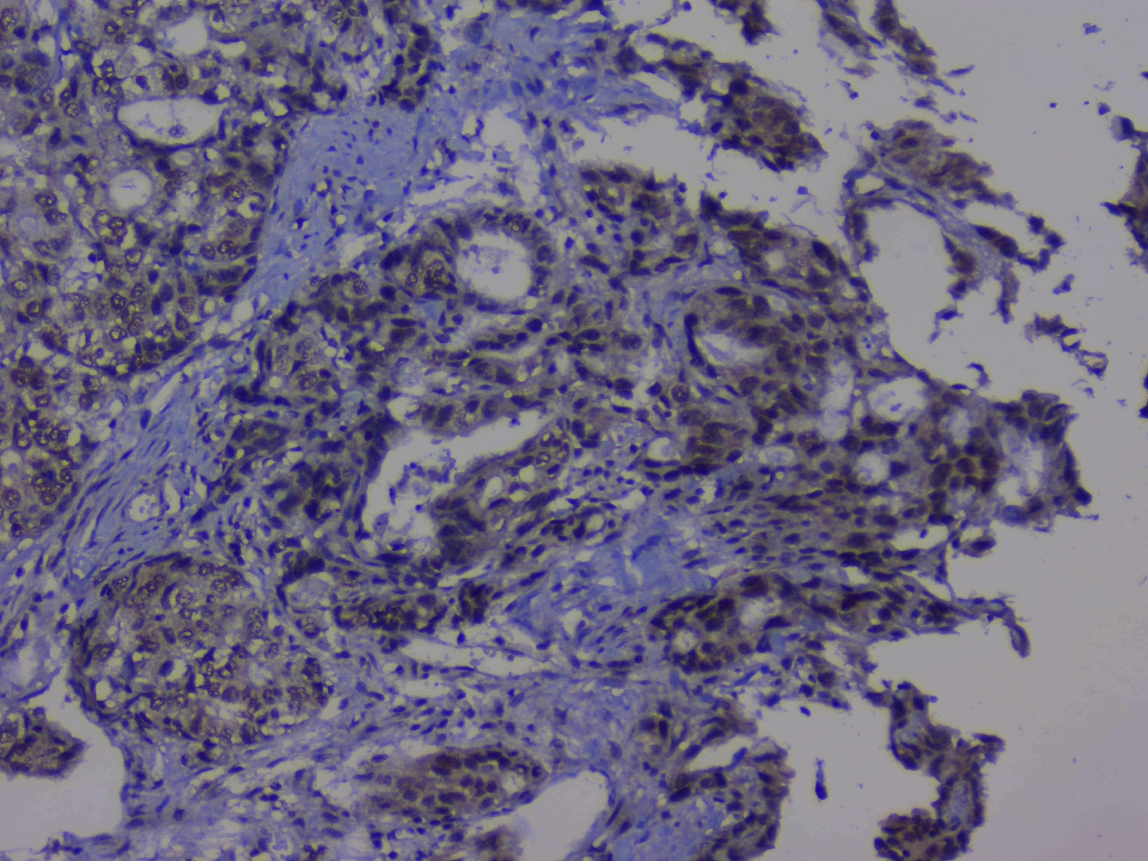 NRF1 / NRF-1 Antibody