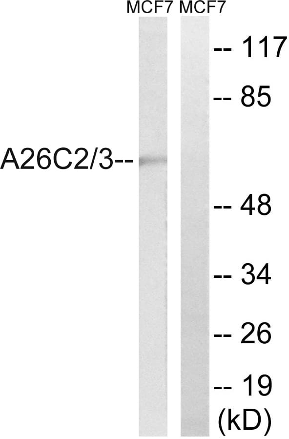 POTEH Antibody (aa178-227)