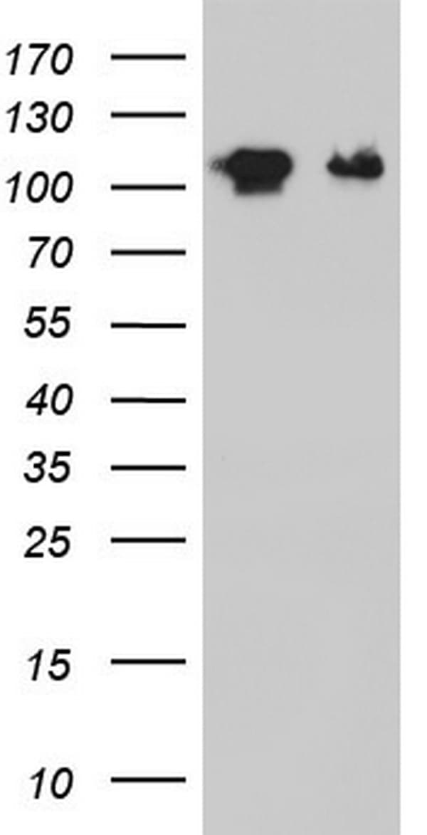GLI / GLI1 Antibody (aa755-1106, clone OTI2E5)