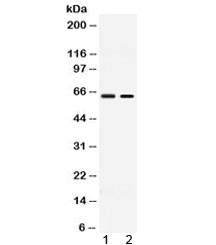 Polyclonal Rabbit anti-Human ACCN1 / ASIC2 Antibody (WB)