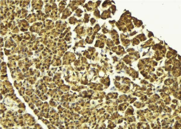 Polyclonal Rabbit anti-Human IKBKG / NEMO / IKK Gamma Antibody (IHC, IF, WB)