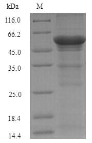 Sorangium cellulosum uxuA Protein (Recombinant 6His-SUMO, N-terminus)