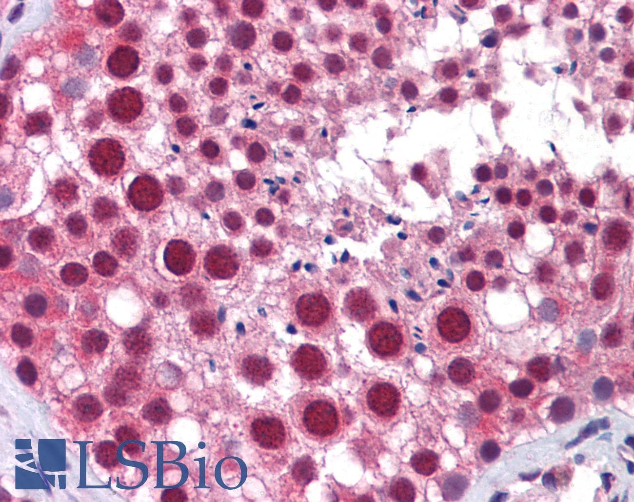 IHC-plus™ MED17 / TRAP80 Antibody (clone 4D4)
