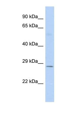 FEV / PET1 Antibody (aa149-198)