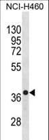 CXCR4 Antibody (aa50-79)