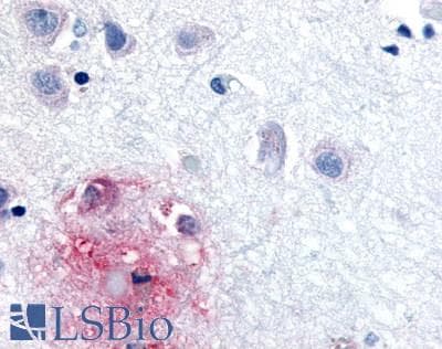 PathPlus™ Polyclonal Rabbit anti-Human RORB / ROR Beta Antibody (Ligand-binding Domain, IHC)
