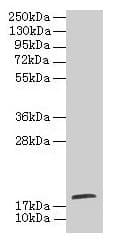 Polyclonal Rabbit anti-Human TPPP2 Antibody (IHC, WB)