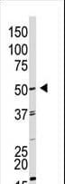 GDF9 / GDF-9 Antibody (aa30-59)