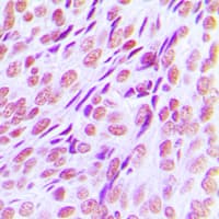 AML1 / RUNX1 Antibody (Internal)