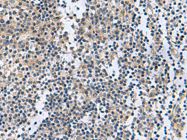 RGS2 Antibody