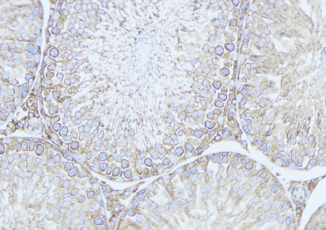 Polyclonal Rabbit anti-Human MRAP Antibody (IHC, WB)