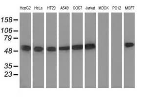 TUBA8 / Tubulin Alpha 8 Antibody (clone OTI2C2)