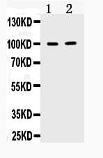 TACC1 Antibody