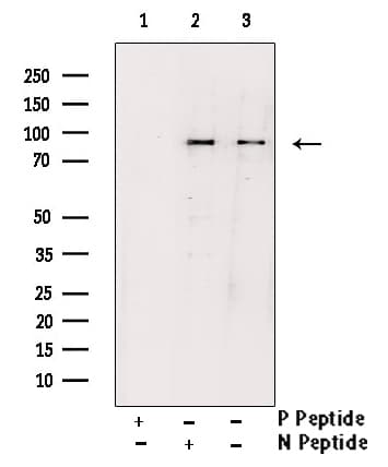 IKBKB / IKK2 / IKK Beta Antibody (phospho-Tyr188)