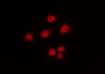 Polyclonal Rabbit anti-Human HNF4A / HNF4 Antibody (phospho-Ser313, IHC, IF, WB)
