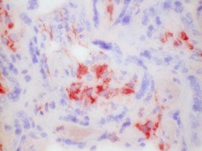 CD163 Antibody