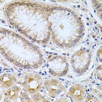 CPM / Carboxypeptidase M Antibody