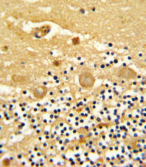 Polyclonal Rabbit anti-Human LRRC32 Antibody (aa234-260, IHC, WB)