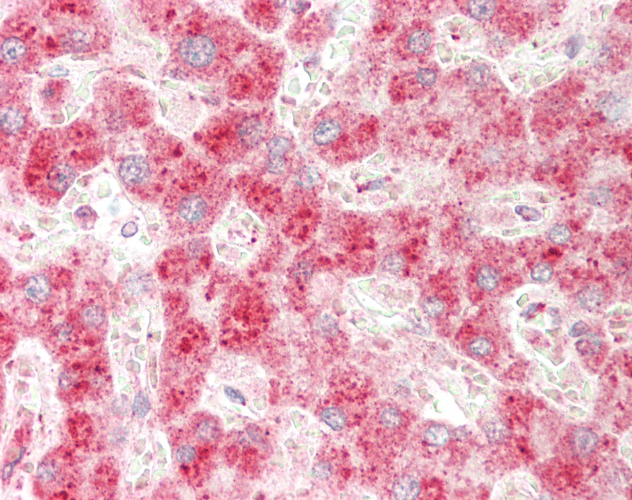 IHC-plus™ Polyclonal Rabbit anti-Human USP25 Antibody (IHC, IF, WB)