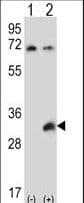 TSSK6 Antibody (aa198-228)