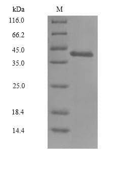 Mouse QPCT / QC Protein (Recombinant 6His, N-terminus)